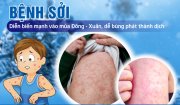 BÀI TRUYỀN THÔNGPHÒNG CHỐNG BỆNH SỞI